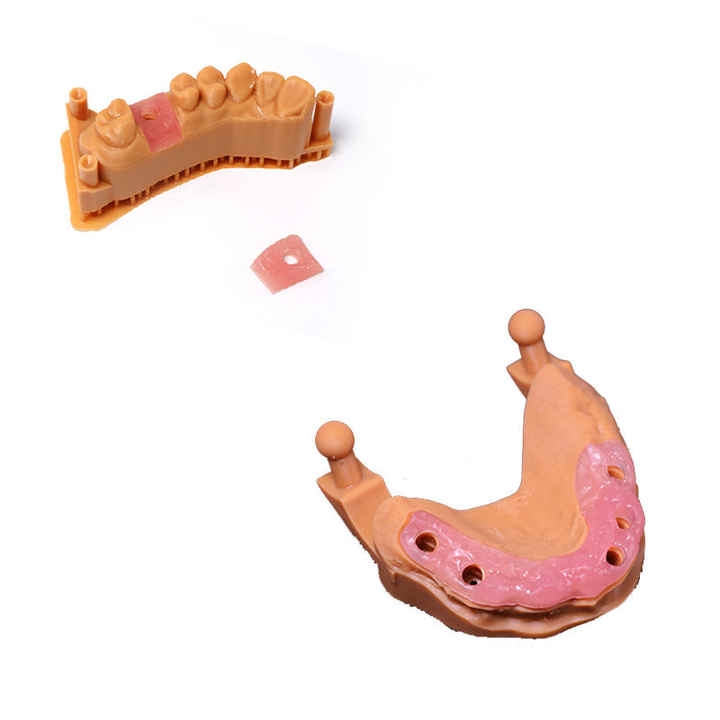 Advancing Prosthodontics: The Role of Digital Dentistry in Denture&nbsp;Fabrication